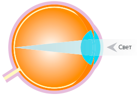 Typical Eye Typical Eye