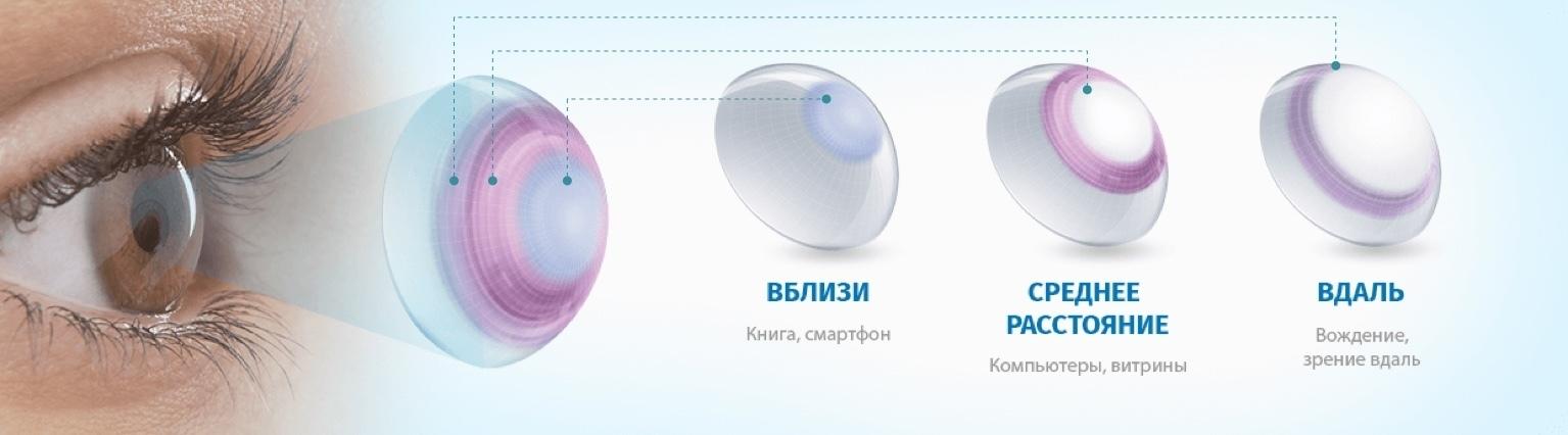 Почему сложно подобрать торические линзы | CooperVision Russia